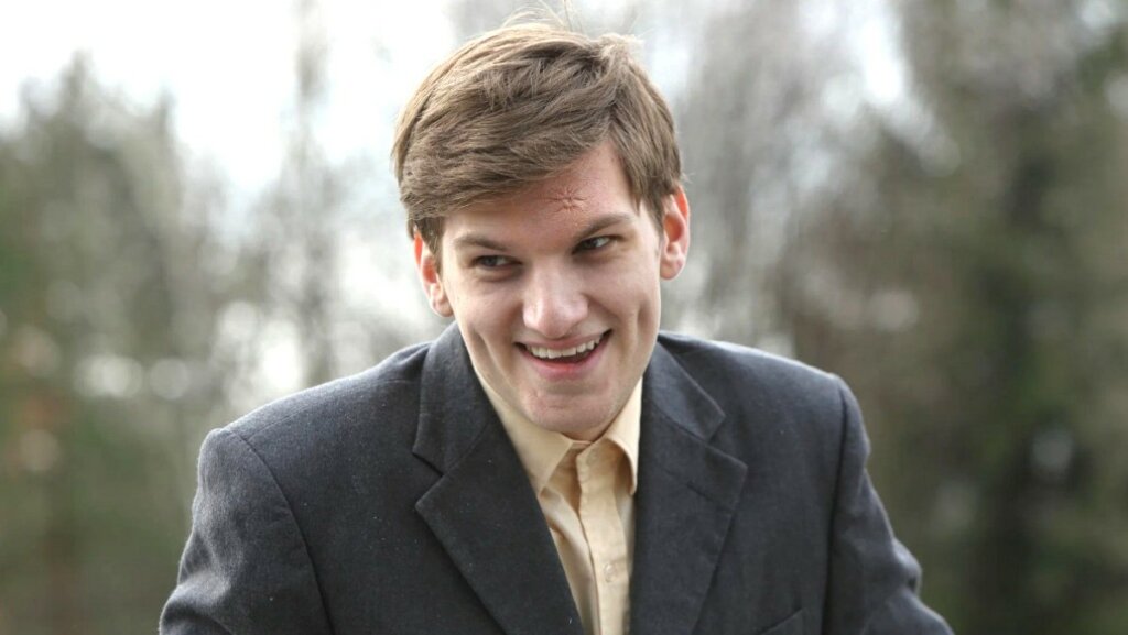 Со звездой «Слово пацана» произошло несчастье: «Сломано все: скулы, нос, челюсть»