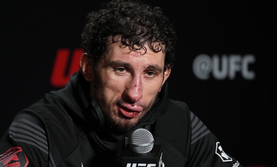 Петросяну серьезно досталось на турнире UFC Вегас 49. Фото: Global Look Press